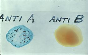 testy alergiczne, Almed B.G. Ludwikowscy, Bydgoszcz