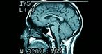 Dominika Skrok-Wolska lek. med. spec. neurolog, psychiatra, neurolog prywatnie, psychiatra prywatnie, psychiatra, Bydgoszcz