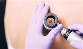 badanie dermatologiczne, Gabinet Medycyny Estetycznej, Dermatologii i Alergologii prof. dr hab. med. Romuald Olszański, Gdynia