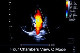 echo serca, Sidorowicz Krystyna dr n. med. kardiolog, Częstochowa