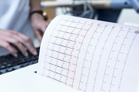 badanie rtg, Katarzyna Michalak Praktyka Lekarska, Katowice