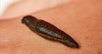 Gabinet Hirudoterapii - Naturalne Metody Leczenia Pijawkami Małgorzata Wywiał