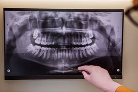 USG zębów, Domadent Gabinet Stomatologiczny, Chorzów