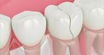 NZOZ Dental