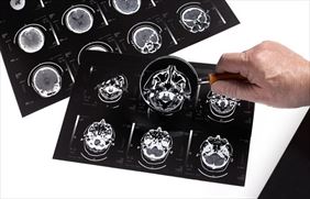 neurolog dziecięcy, Barbara Achtelik-Frolik Specjalistyczny gabinet lekarski, Sucha Beskidzka