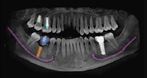 Gabinet Stomatologiczny Magdalena Kaczor & Stanisław Adam Kaczor Gabinet Stomatologiczny Magdalena Kaczor & Stanisław Adam Kaczor, stomatologia zachowawcza, leczenie kanałowe, leczenie endodontyczne, Ostrowsko