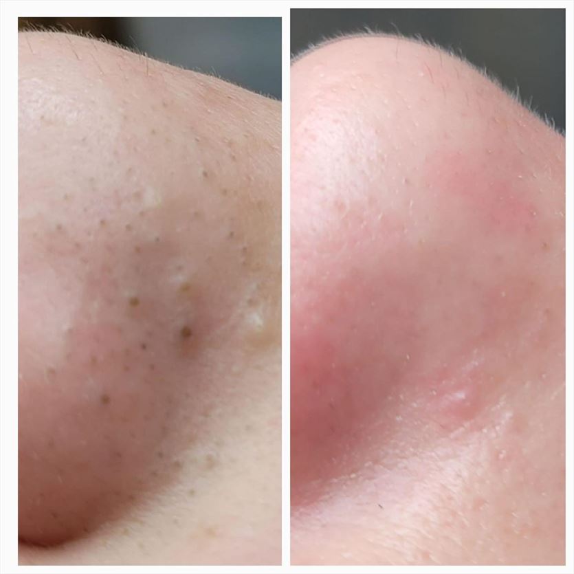 Zabiegi kosmetyczne na twarz i ciało, Ellaclinic Medycyna Estetyczna Elżbieta Kozdęba, Ostrowiec Świętokrzyski