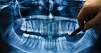 NZOZ Poradnia Stomatologiczna, Indywidualna Praktyka Stomatologiczna lek. dent. Wiktoria Pak, leczenie kanałowe pod mikroskopem, endodoncja mikroskopowa, leczenie zębów pod mikroskopem, Ostrów Wielkopolski