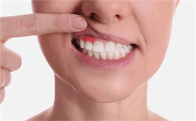 leczenie dziąseł, Dentimed NZOZ Poradnia stomatologiczna, Lublin