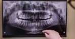 Optimum Stomatologia Dr N. Med. Monika Litko-Rola, stomatolog, dentysta, stomatologia, Lublin
