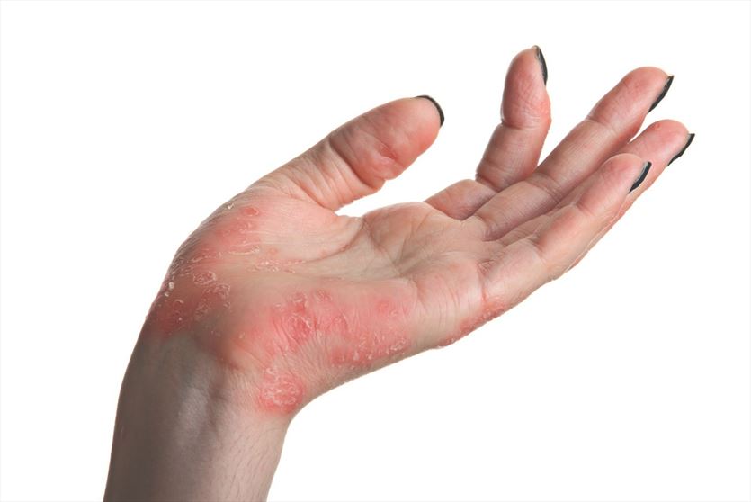 przyjazna Lekarze - dermatolodzy, Niepubliczny Zakład Opieki Zdrowotnej Agnieszka Owczarczyk-Saczonek Sp k, Olsztyn