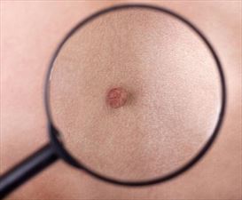 choroby skóry, Dermatolog Małgorzata Karska Piła, Piła