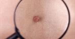 Małgorzata Karska Prywatny Gabinet Dermatologiczny