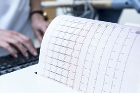 EKG, Prof Dr Hab. Med. Krzysztof Błaszyk Specjalistyczny Gabinet Kardiolog Internista, Poznań