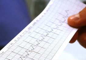 badanie, Prof Dr Hab. Med. Krzysztof Błaszyk Specjalistyczny Gabinet Kardiolog Internista, Poznań