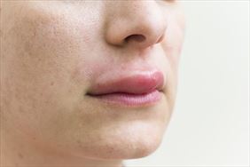 alergia, Alergo-Med Sp. z o. o. Specjalistyczna Przychodnia Lekarska, Poznań