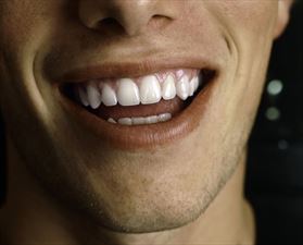 dentysta, Super Dent Gabinet Stomatologiczny dr. Jolanta Młyńczak, Konin