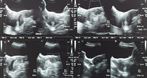 Vitali Kostusev Indywidualna Praktyka Lekarska Diagnostyka ultrasonograficzna