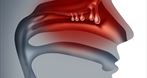 Mediks Centrum laryngologii Otolaryngolog Jolanta Marciniak