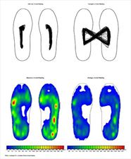 badanie stóp, Formed Plus Sp. z o.o. sp.k., Warszawa