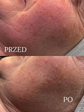 usługi kosmetyczne, MW&Holistic Beauty Centrum Kosmetologii i Zdrowego Odżywiania, Warszawa