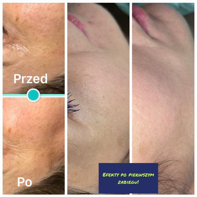 Zabiegi kosmetyczne na ciało i twarz, MW&Holistic Beauty Centrum Kosmetologii i Zdrowego Odżywiania, Warszawa