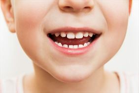 stomatologia dziecięca, Well Denti Sp. z o.o., Warszawa