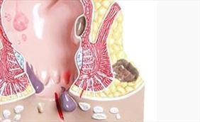 Anna Bielec-Michałowska Prywatny gabinetukład pokarmowy dolny odcinek, Anna Bielec-Michałowska Prywatny gabinet chirurgiczny, Opole