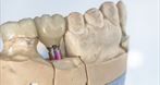 Grzegorz Gdula Vita-Dent Stomatologia, ortodoncja, gabinet dentystyczny, implanty zębów, Kiełczów