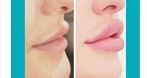 Medbeauty Klinika Medycyny Estetycznej dr Andrzej Kępa