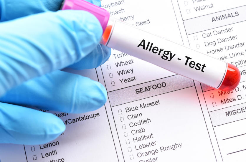 Kiedy należy zrobić testy alergiczne Kiedy należy zrobić testy alergiczne