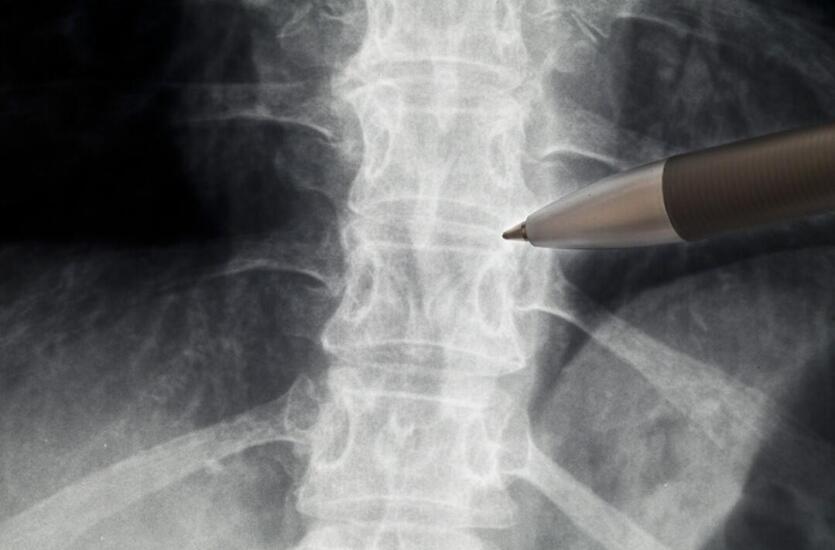 Badanie postawy ciała - metody diagnostyki wad postawy