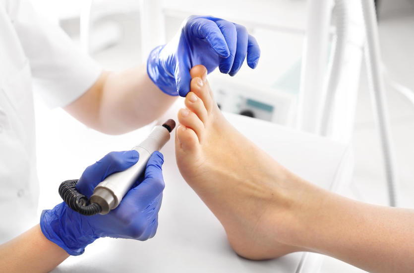 Pedicure podologiczny – kiedy warto zdecydować się na jego wykonanie?