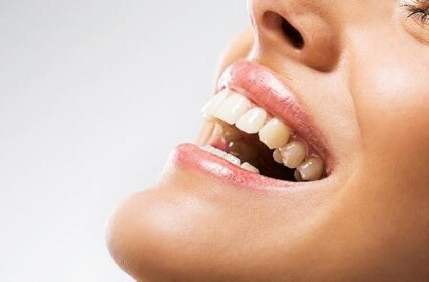 Licówki porcelanowe – popraw swój uśmiech