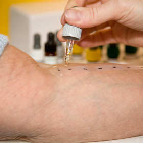 Jak wyglądają testy alergiczne?