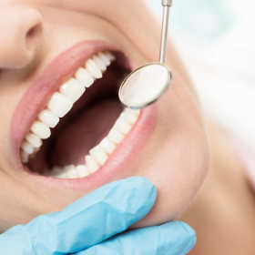 Estetyczna odbudowa zębów złamanych – Mirosława Szczupak Gabinet Stomatologiczny