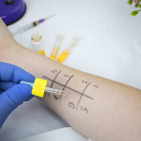  Jakie rodzaje testów są wykonywane w Gabinecie Alergologicznym J. Petryszyna?