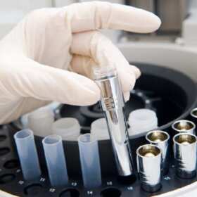 Jak działają lampy bakteriobójcze i wirusobójcze od firmy ELKAR Sprzęt Laboratoryjny?