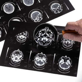 Pełne orzecznictwo neurologiczne w gabinecie dr. n. med. spec. neurologa Jacka Gajosa