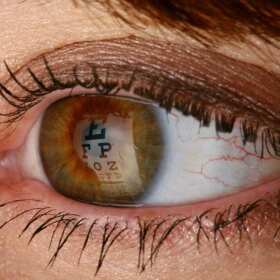 Zwyrodnienie plamki żółtej – jak się objawia i na czy polega leczenie schorzenia? Gabinet okulistyczny Oculus