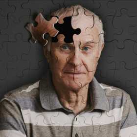 Pierwsze objawy choroby Alzheimera - kiedy udać się do neurologa? Dr. n. med. spec. neurolog Jacek Gajos