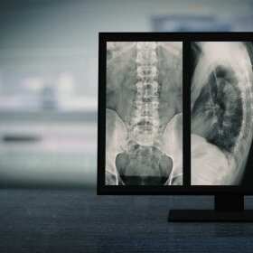 Przeglądy techniczne aparatury rentgenowskiej diagnostycznej i stomatologicznej - Magal