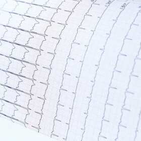 Jak przygotować się do badania EKG w ramach medycyny pracy?