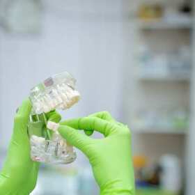 Implanty zębowe - Jakie są możliwe rozwiązania? | Gabinet Stomatologiczny Mirosława Szczupak