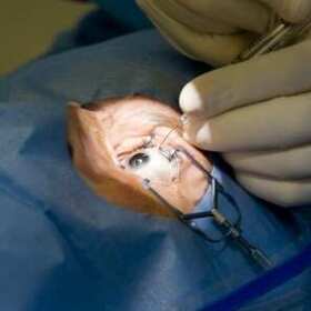 Chirurgia okulistyczna w Łodzi - Zbigniew Wyrzykowski