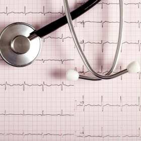 Badania EKG w Medan – diagnostyka układu sercowo-naczyniowego