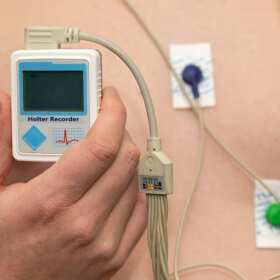 Holter EKG - monitorowanie serca dzieci w Katowicach