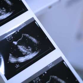 Nowoczesne metody diagnostyki ginekologicznej w Gdańsku