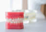 Zęby sztuczne — jakie rodzaje oferuje rynek?