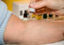 Jak wyglądają testy alergiczne?